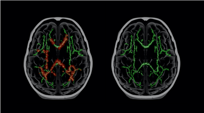 Expanding Our Understanding of Brain Injuries - Q30